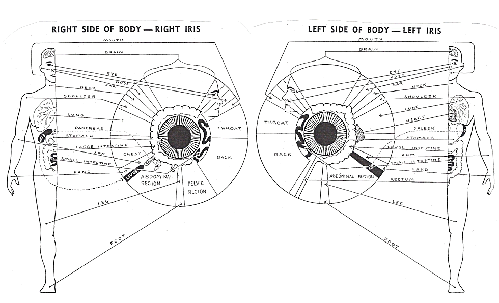 Dr Jensen Iridology Chart